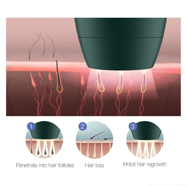 Home Laser Hair Removal Device - Image 3